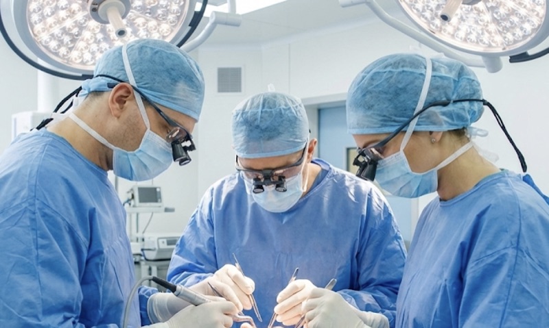 植毛専門チーム