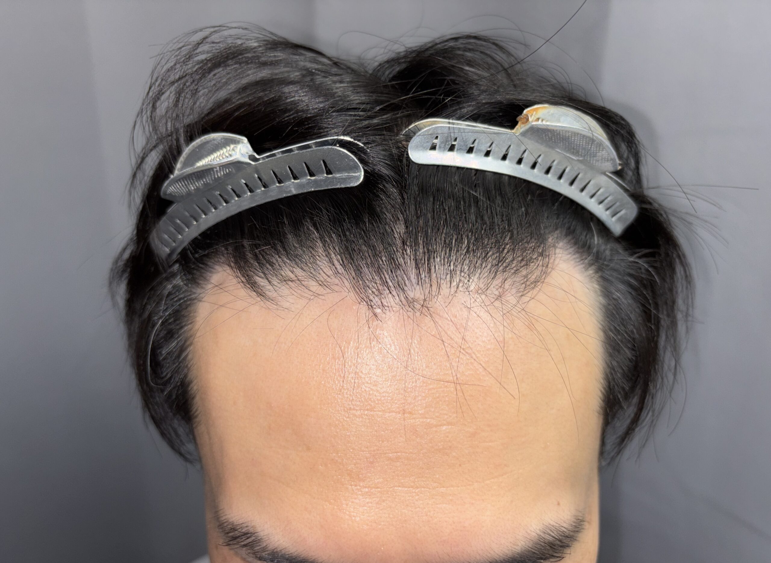 正面やや上方から