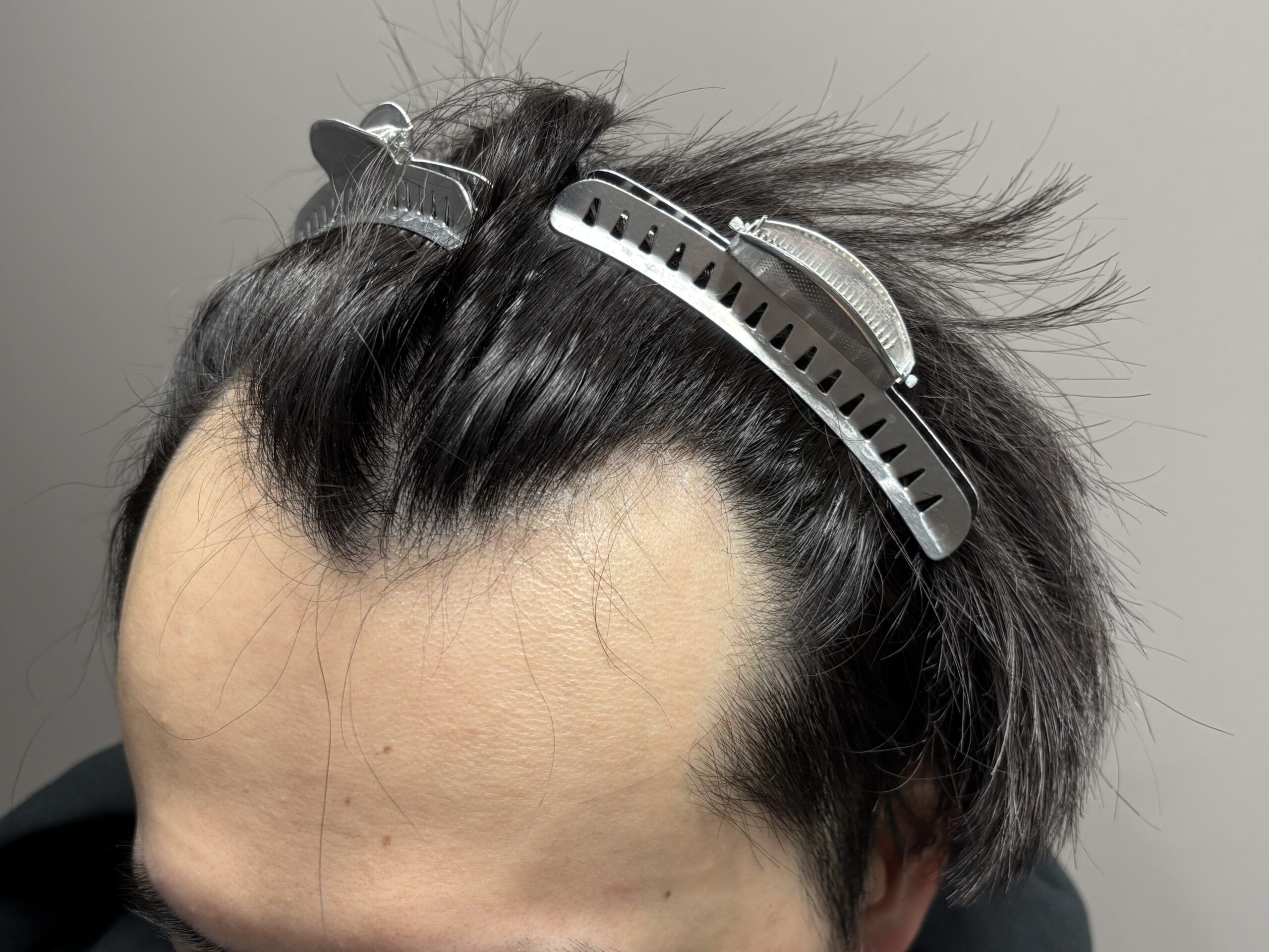 左側