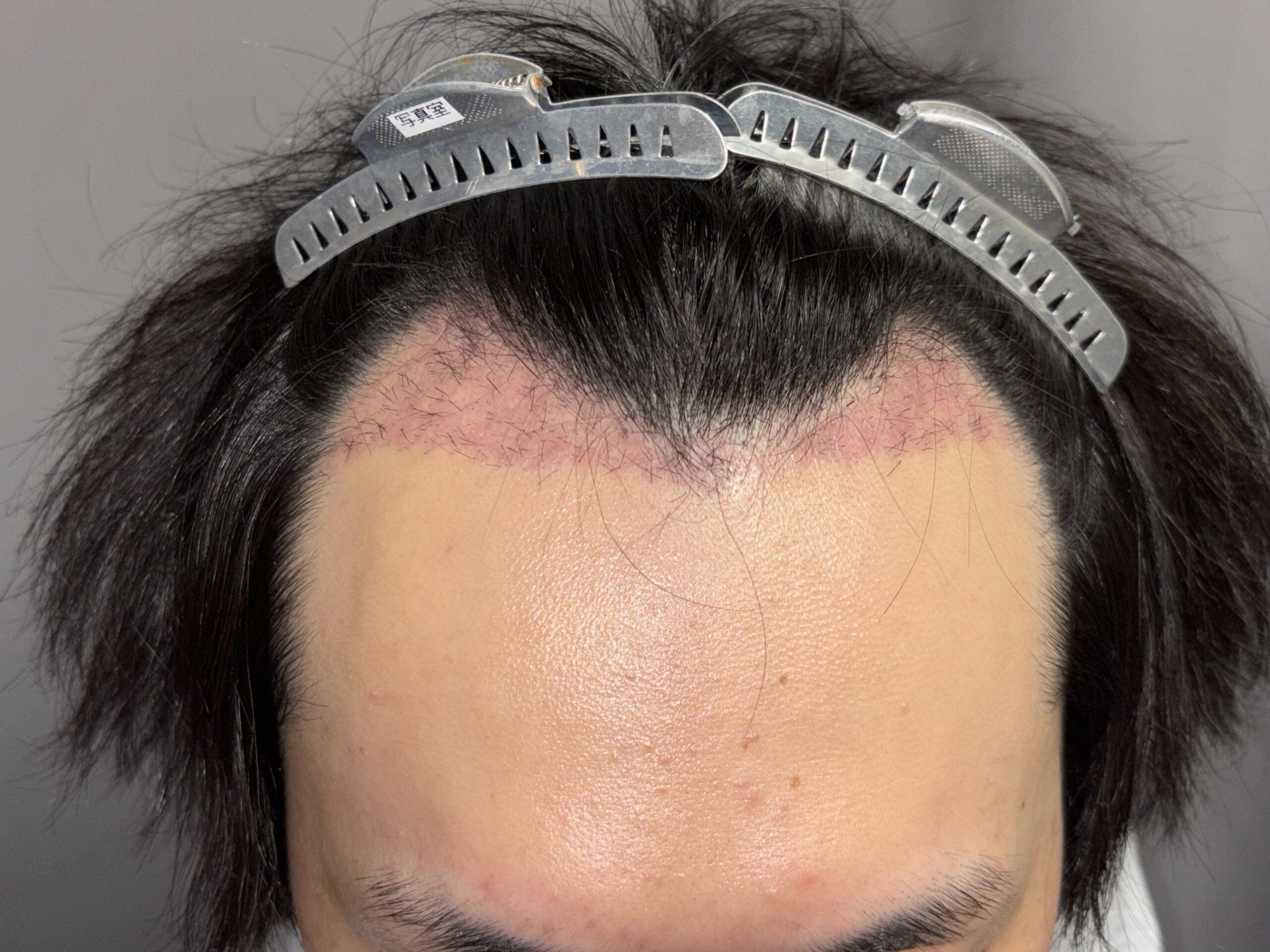正面